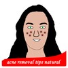 Acne Removal Tips Natural