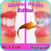 Braces Photo Editor 2017