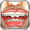 Braces Surgery