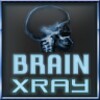 BrainXray