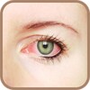 Cómo Quitar Los Ojos Rojos