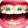 Dental Brace Booth
