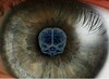 H-EMDR