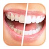How To Whiten Your Teeth