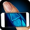Simulator X-Ray Fingers Joke