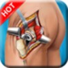 Virtual Hip Surgery