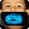 X-Ray Teeth Joke