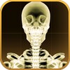 X-ray