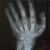 Xray Cam