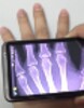 XRay Scan