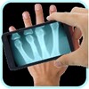 Xray Scanner