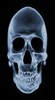 XRay